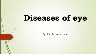 Diseases of eye
By ; Dr. Bushra Ahmad
 
