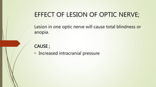 EFFECT OF LESION OF OPTIC NERVE;
Lesion in one optic nerve will cause total blindness or
anopia.
CAUSE ;
• Increased intracranial pressure
 