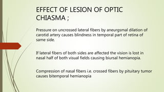 EFFECT OF LESION OF OPTIC
CHIASMA ;
Pressure on uncrossed lateral fibers by aneurgsmal dilation of
carotid artery causes blindness in temporal part of retina of
same side.
If lateral fibers of both sides are affected the vision is lost in
nasal half of both visual fields causing biursal hemianopia.
Compression of nasal fibers i.e. crossed fibers by pituitary tumor
causes bitemporal hemianopia
 