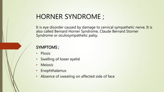 HORNER SYNDROME ;
It is eye disorder caused by damage to cervical sympathetic nerve. It is
also called Bernard Horner Syndrome, Claude Bernard Storner
Syndrome or oculosympathetic palsy.
SYMPTOMS ;
• Ptosis
• Swelling of lower eyelid
• Meiosis
• Enophthalamus
• Absence of sweating on affected side of face
 
