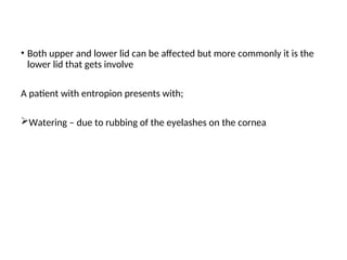 Diseases of eyelids.ppt . . . . . . . . | PPT