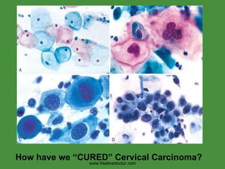 Diseases of female genital system | PPT