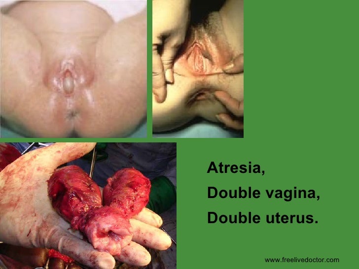 doppelvagina doppelvagina