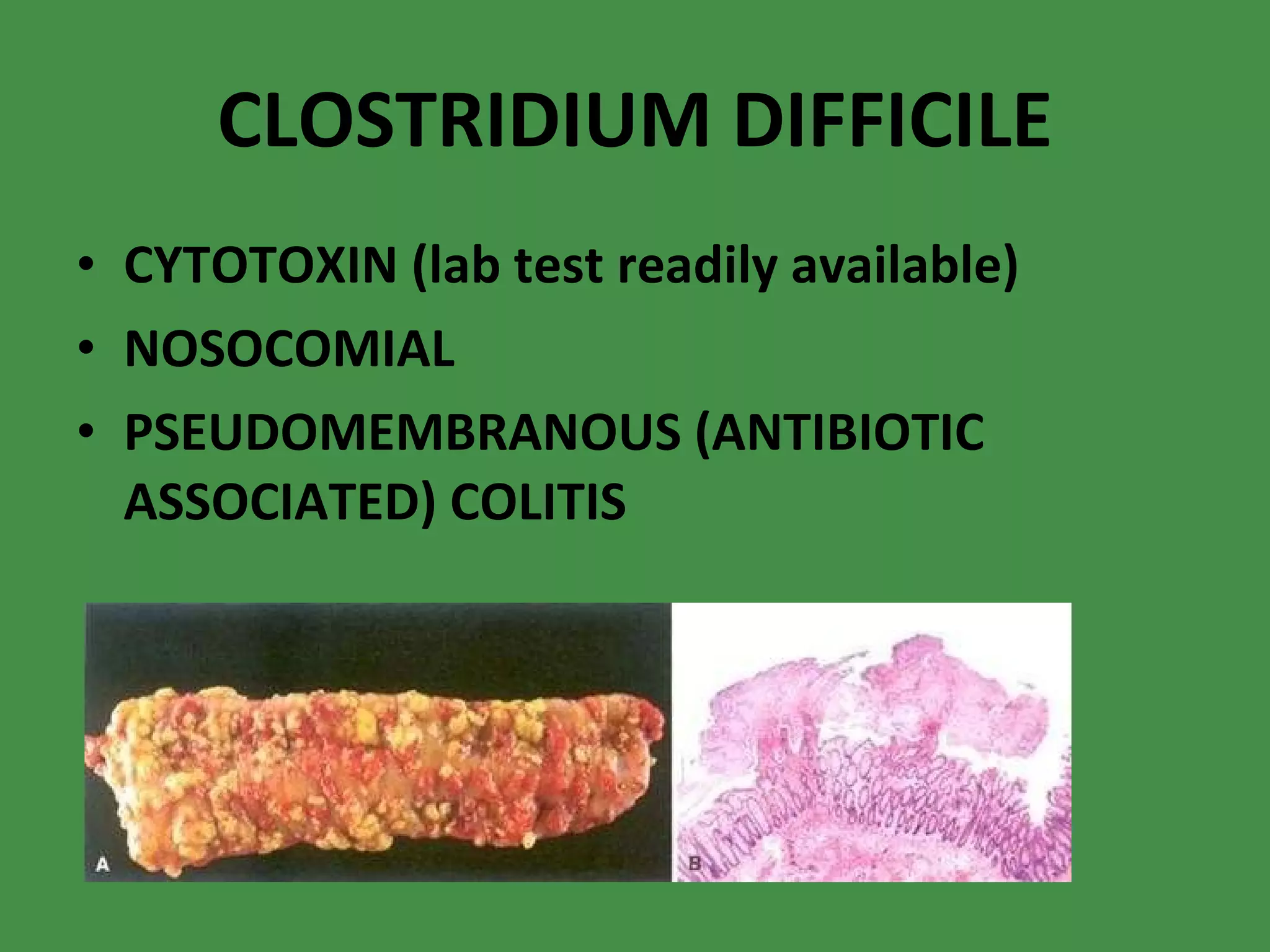 CLOSTRIDIUM DIFFICILE CYTOTOXIN (lab test readily available) NOSOCOMIAL PSEUDOMEMBRANOUS (ANTIBIOTIC ASSOCIATED) COLITIS 
