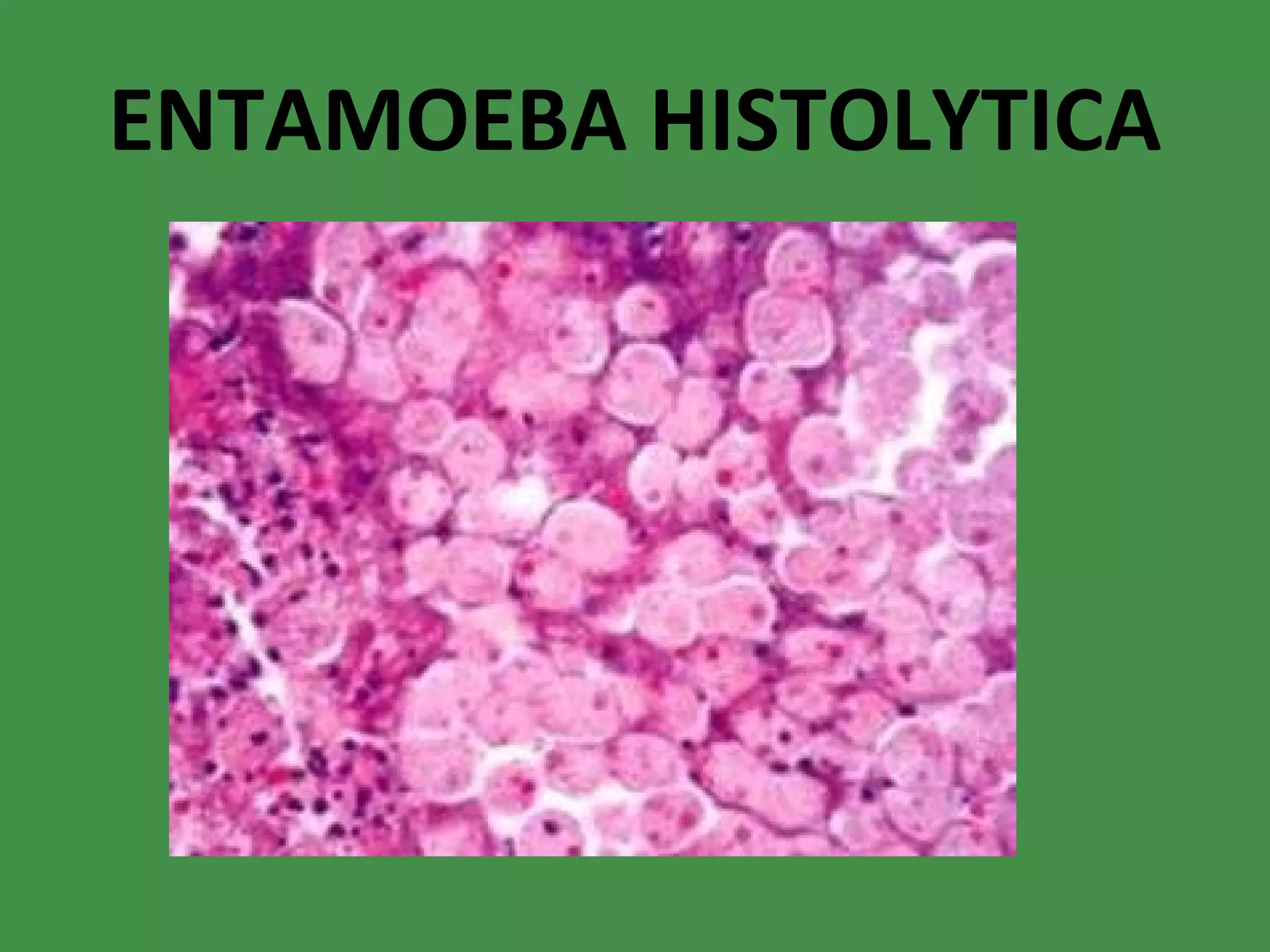 ENTAMOEBA HISTOLYTICA 