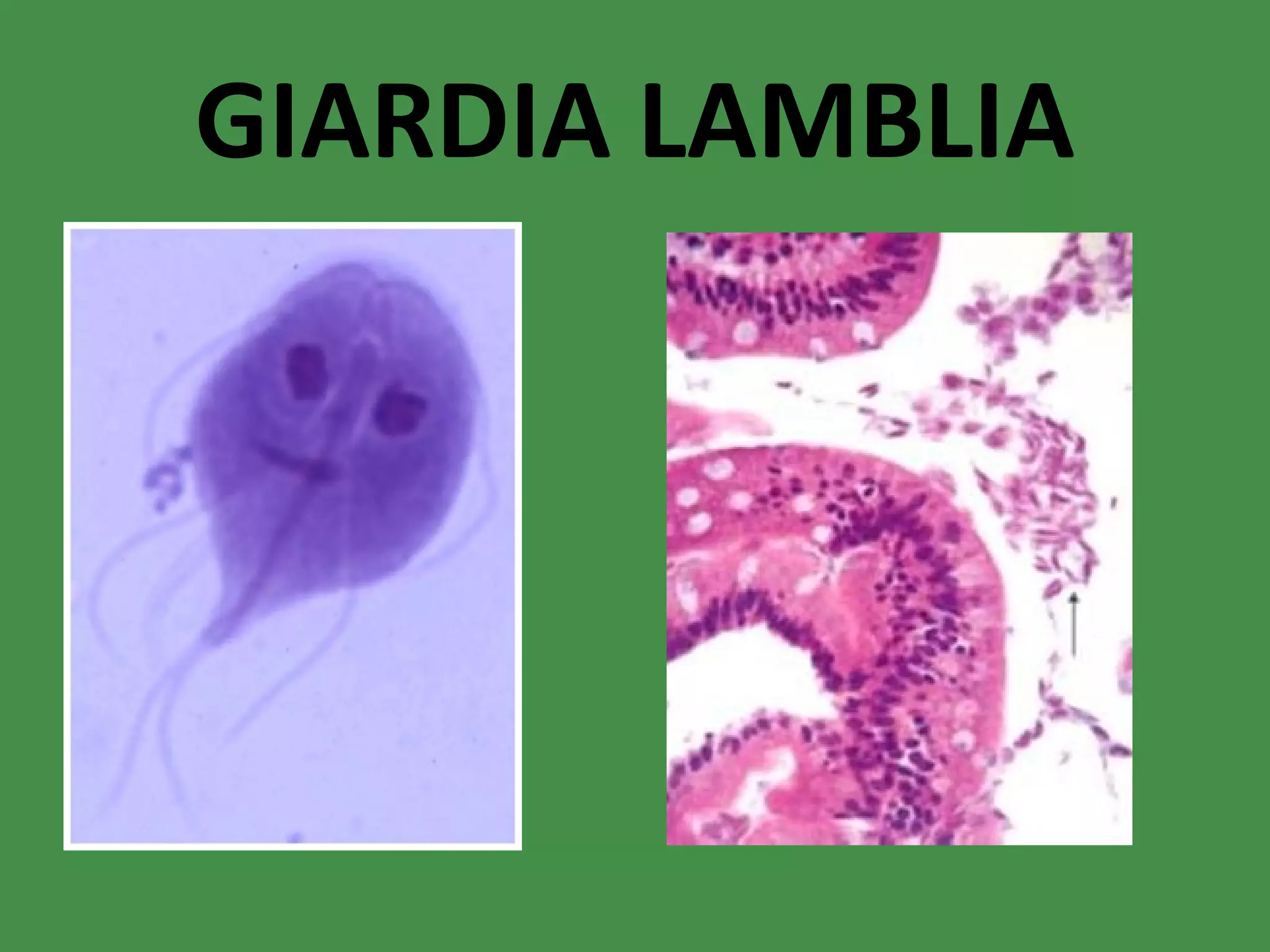 GIARDIA LAMBLIA 