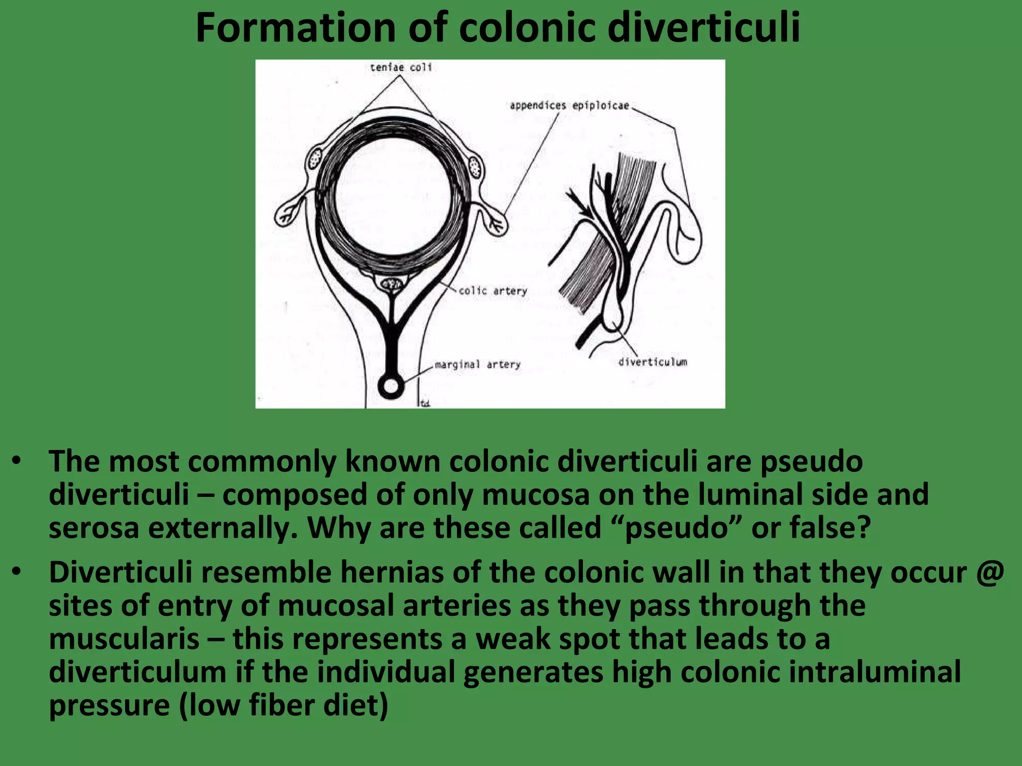Formation of colonic diverticuli The most commonly known colonic diverticuli are pseudo diverticuli – composed of only mucosa on the luminal side and serosa externally. Why are these called “pseudo” or false? Diverticuli resemble hernias of the colonic wall in that they occur @ sites of entry of mucosal arteries as they pass through the muscularis – this represents a weak spot that leads to a diverticulum if the individual generates high colonic intraluminal pressure (low fiber diet) 