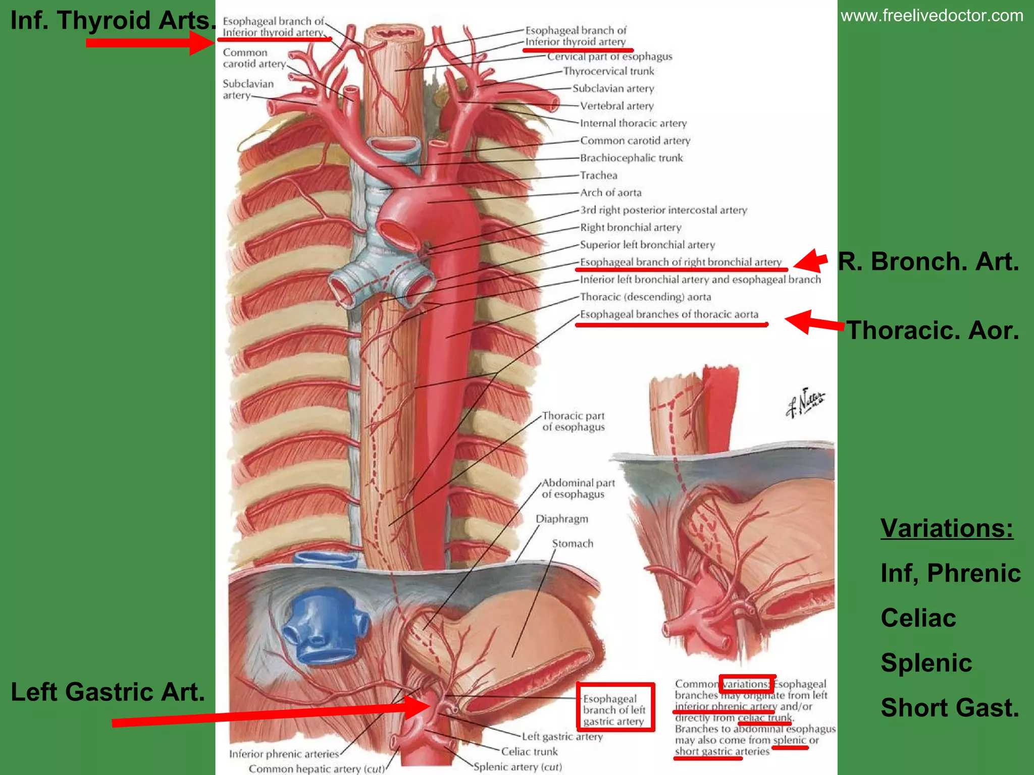 Inf. Thyroid Arts. R. Bronch. Art. Thoracic. Aor. Left Gastric Art. Variations: Inf, Phrenic Celiac Splenic Short Gast. www.freelivedoctor.com 