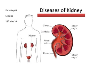 Diseases of Kidney  Pathology-B Lab pics 25th May’10 