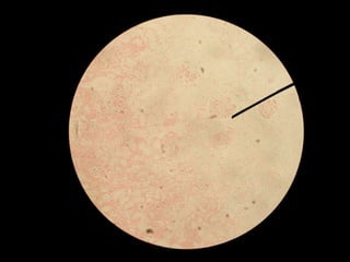 Liber Patho Diseases of kidney patho lab pics | PPTX