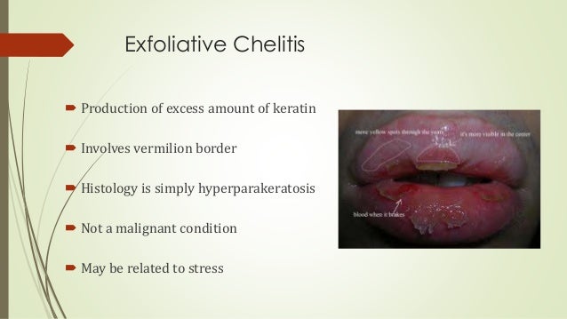 diseases of lips tongue lip diseases