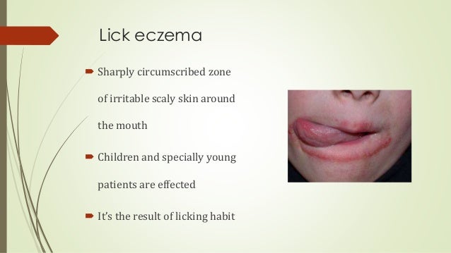 diseases of lips tongue lip diseases