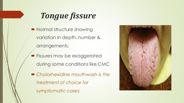 Diseases of lips & tongue
