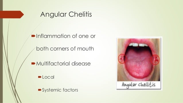 lip diseases