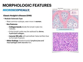 Diseases of Lymph node & Spleen - Pathology | PDF