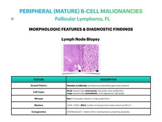 Diseases of Lymph node & Spleen - Pathology | PDF