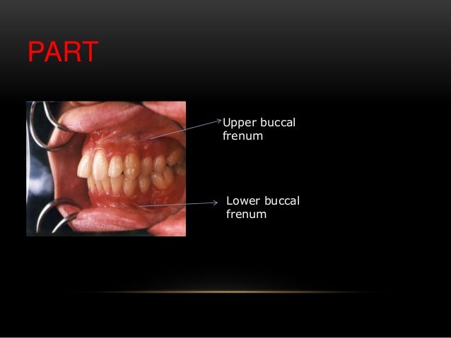 Diseases of mouth, palate, lips & cheek