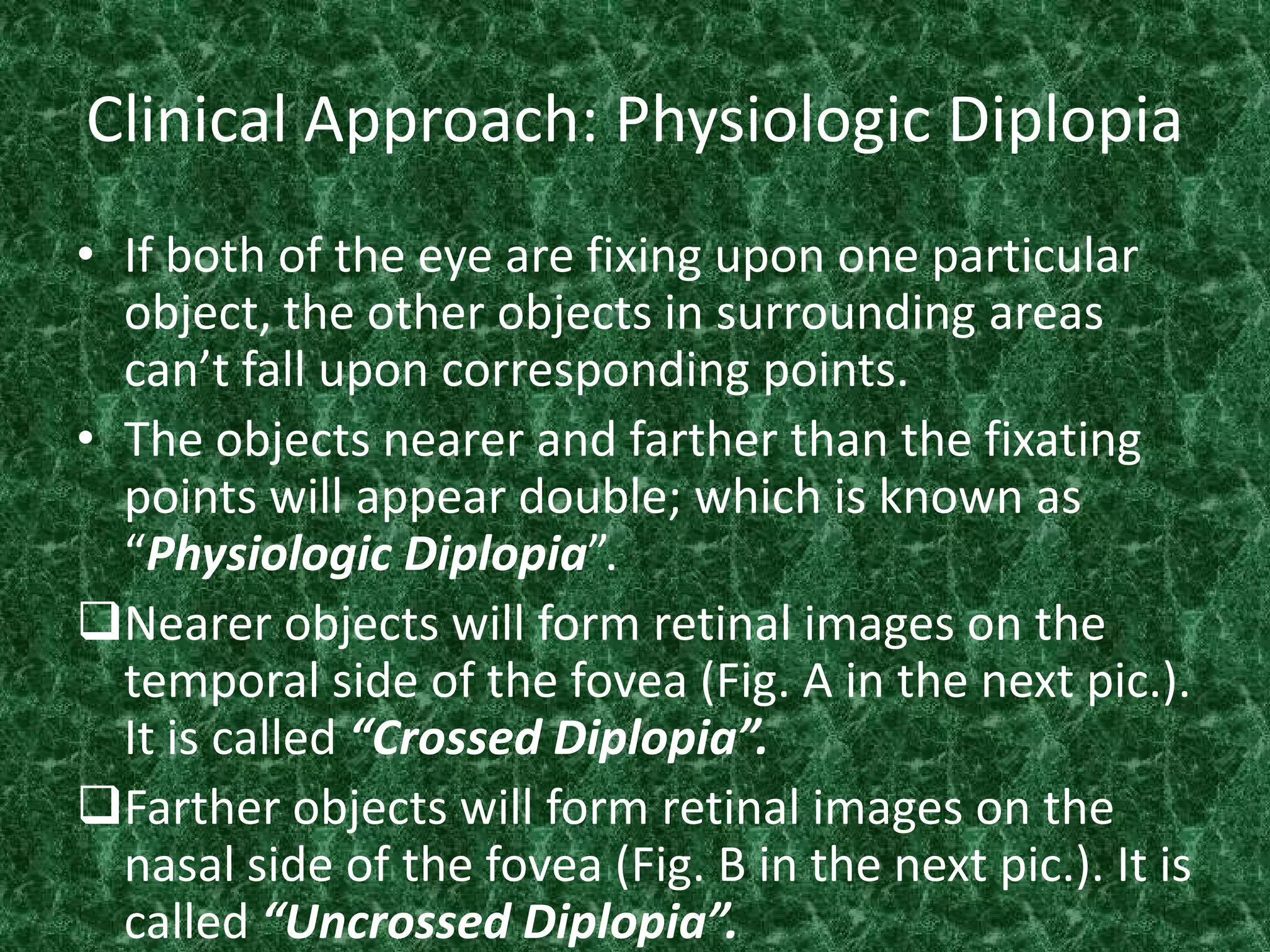 Clinical Approach: Physiologic Diplopia
• If both of the eye are fixing upon one particular
object, the other objects in surrounding areas
can’t fall upon corresponding points.
• The objects nearer and farther than the fixating
points will appear double; which is known as
“Physiologic Diplopia”.
Nearer objects will form retinal images on the
temporal side of the fovea (Fig. A in the next pic.).
It is called “Crossed Diplopia”.
Farther objects will form retinal images on the
nasal side of the fovea (Fig. B in the next pic.). It is
called “Uncrossed Diplopia”.

 