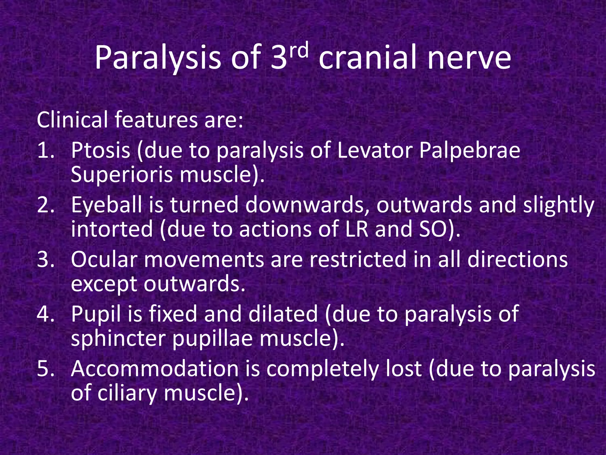 Paralysis of 3rd cranial nerve
Clinical features are:
1. Ptosis (due to paralysis of Levator Palpebrae
Superioris muscle).
2. Eyeball is turned downwards, outwards and slightly
intorted (due to actions of LR and SO).
3. Ocular movements are restricted in all directions
except outwards.
4. Pupil is fixed and dilated (due to paralysis of
sphincter pupillae muscle).
5. Accommodation is completely lost (due to paralysis
of ciliary muscle).

 
