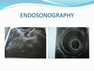 ENDOSONOGRAPHY
 