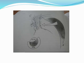 diseasesofoesophagus-141014153402-conversion-gate01.pdf