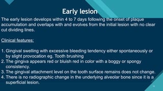 Diseases of Periodontium perio ppt 2.pptx
