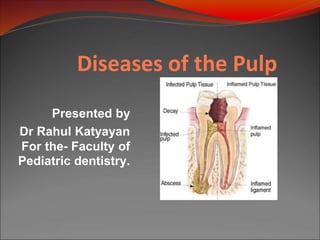 Diseases of the Pulp
Presented by
Dr Rahul Katyayan
For the- Faculty of
Pediatric dentistry.
 