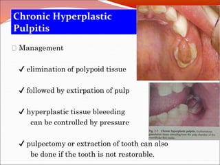 Diseases of pulp | PPTX