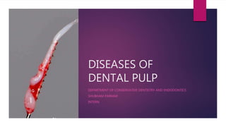 DISEASES OF
DENTAL PULP
DEPARTMENT OF CONSERVATIVE DENTISTRY AND ENDODONTICS
SHUBHAM PARMAR
INTERN
 