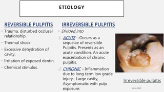 REVERSIBLE PULPITIS
• Trauma, disturbed occlusal
relationship.
• Thermal shock
• Excessive dehydration of
cavity.
• Irrita...
