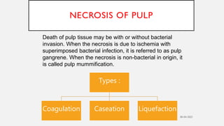 Pulp necrosis may or may not arise with symptoms.
Signs and symptoms of pulpal necrosis include;
.
Pain
Crown
discolourat
...