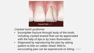 Cracked tooth syndrome
• Incomplete fracture through body of the tooth,
including cracked enamel that can be appreciated
w...