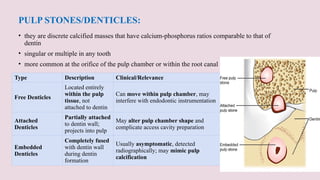 Multiple Pulp Stone Comprehensive Overview of Pulp and Periapical Tissue Diseases in ...