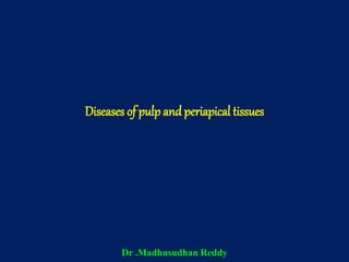 Diseases of pulp and periapical tissues
Dr .Madhusudhan Reddy
 