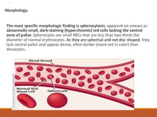 Diseases of Red Blood cells and diseases | PDF