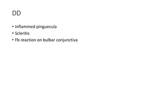 DD
• Inflammed pinguecula
• Scleritis
• Fb reaction on bulbar conjunctiva
 