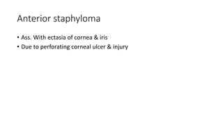 Anterior staphyloma
• Ass. With ectasia of cornea & iris
• Due to perforating corneal ulcer & injury
 