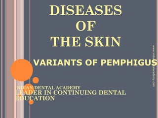 DISEASES
OF
THE SKIN
VARIANTS OF PEMPHIGUS
INDIAN DENTAL ACADEMY
LEADER IN CONTINUING DENTAL
EDUCATION
www.indiandentalacademy.com
 