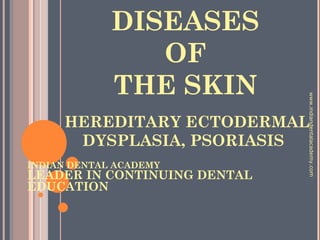 DISEASES
OF
THE SKIN
HEREDITARY ECTODERMAL
DYSPLASIA, PSORIASIS
INDIAN DENTAL ACADEMY
LEADER IN CONTINUING DENTAL
EDUCATION
www.indiandentalacademy.com
 