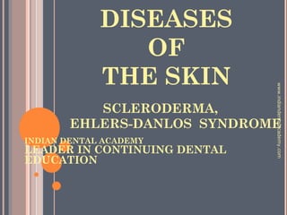 DISEASES
OF
THE SKIN
SCLERODERMA,
EHLERS-DANLOS SYNDROME
INDIAN DENTAL ACADEMY
LEADER IN CONTINUING DENTAL
EDUCATION
www.indiandentalacademy.com
 