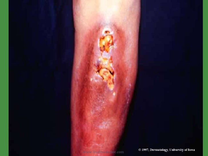 Diseases of skin.... more