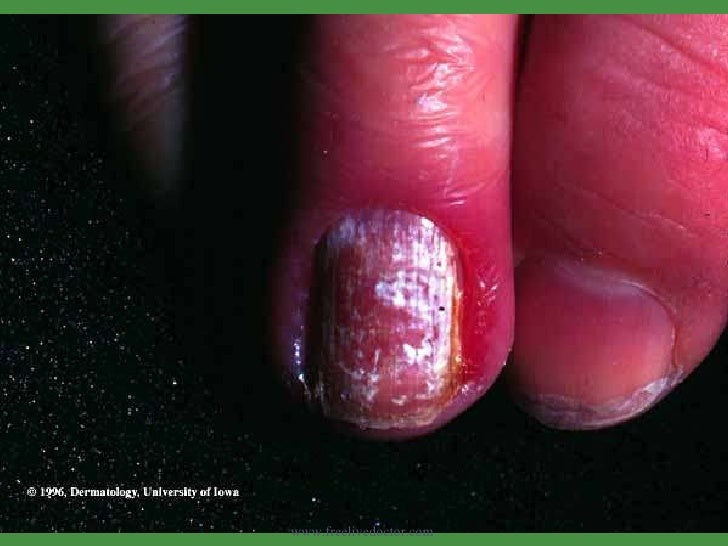 Diseases of skin.... more