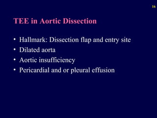 Diseases of the aorta | PPT