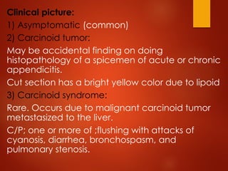 Comprehensive Overview of Acute Appendicitis and Appendix Neoplasms ...