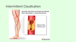 Pathological issues of blood vessel.pptx