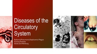 Diseases of the 
Circulatory 
System 
Bubonic/Pneumonic/Septicemic Plague 
Kissing Disease 
Ebola and Marburg 
 