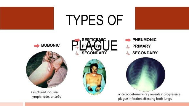 Diseases of the Circulatory System