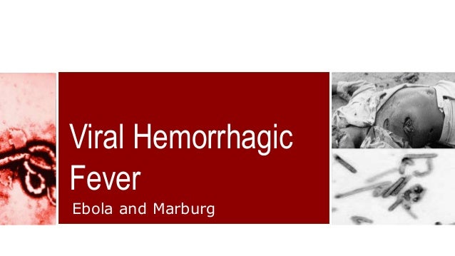 fever lassa how cure to the Diseases System of Circulatory