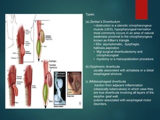 Triangular Protrusion Diseases of the Esophagus by Gabriel MD. | PDF