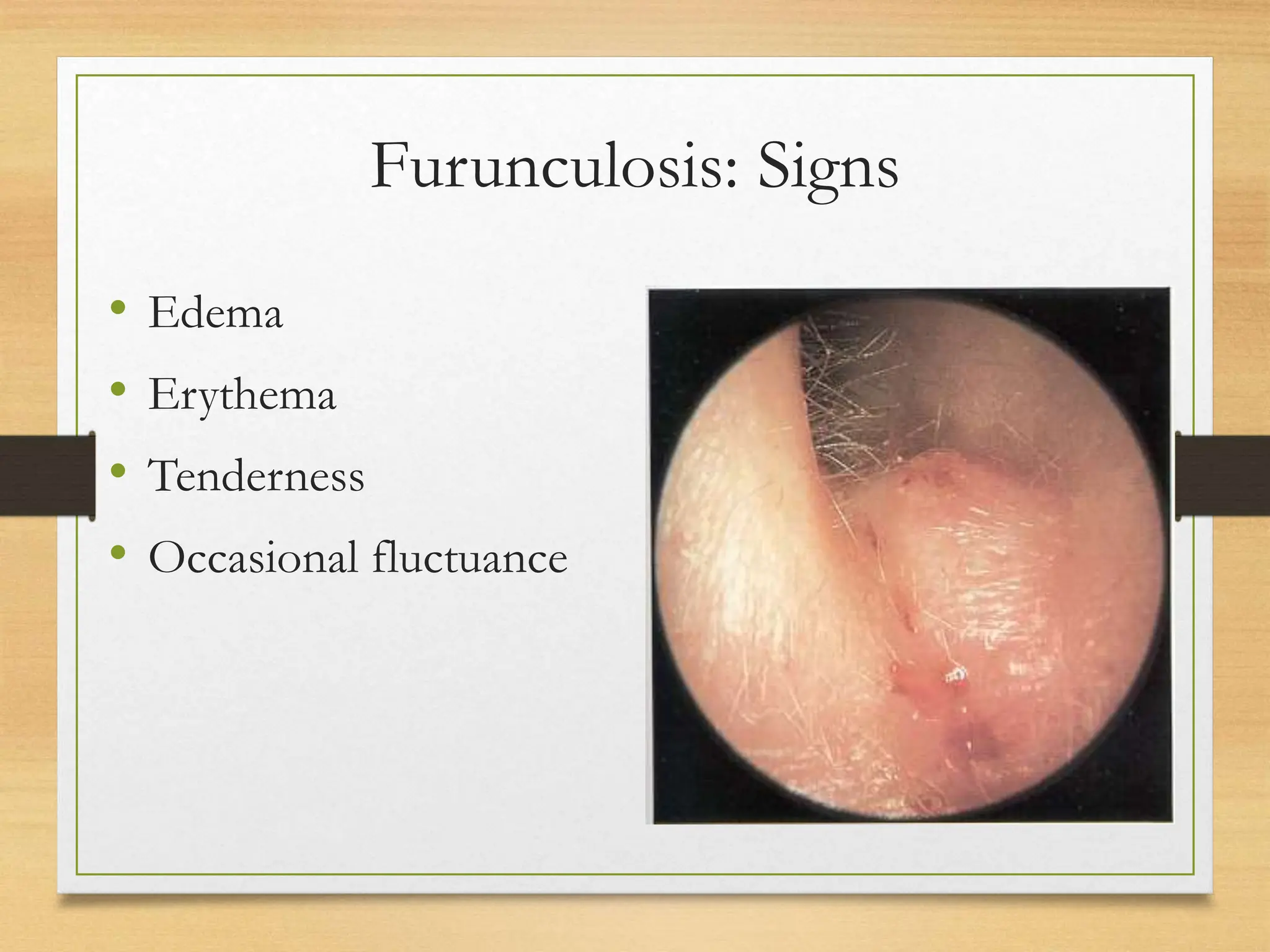 Diseases of the external ear and anatomy of the ear | PPT